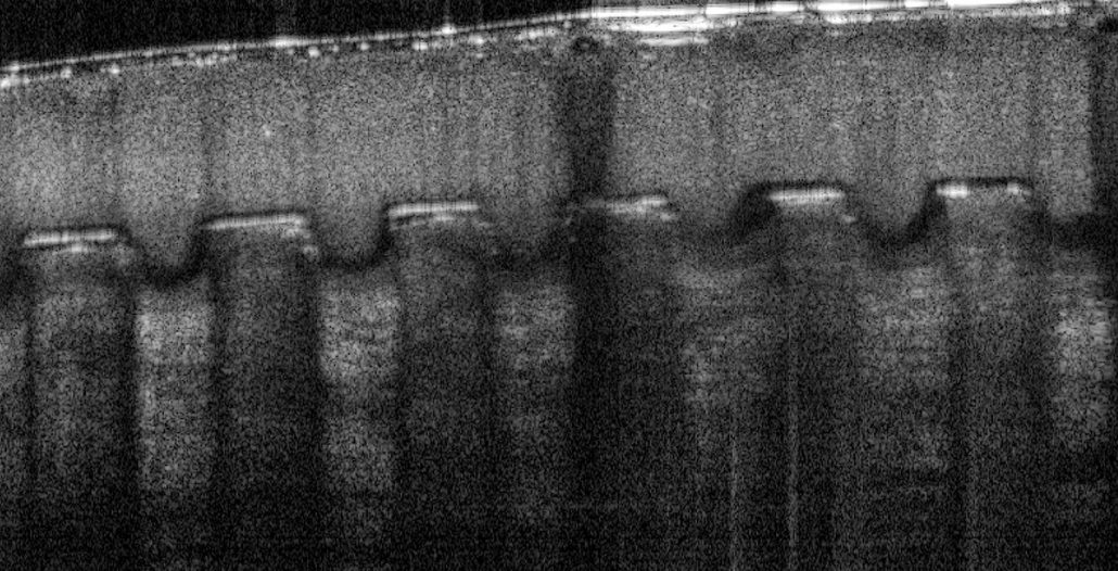 After 4.5 min: Needles have shortened and blunted appearance and are surrounded by black (i.e. non- optically scattering) substance