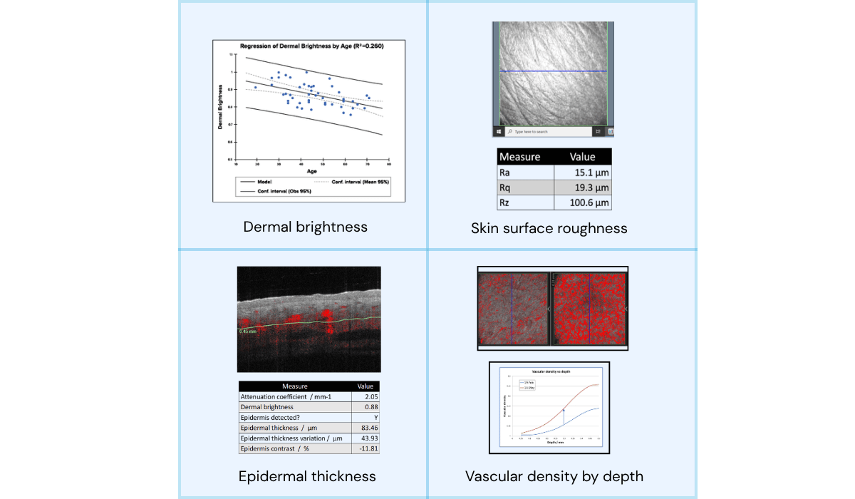 VivoTools skin analysis quantitative endpoints